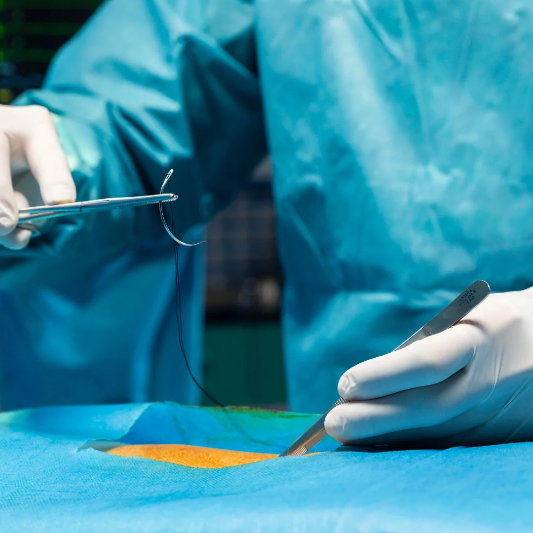 Arthroscopic (Keyhole) Surgeries