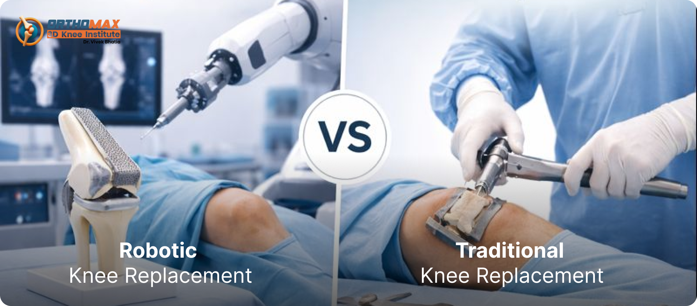Robotic vs Traditional Knee Replacement: Key Differences Explained